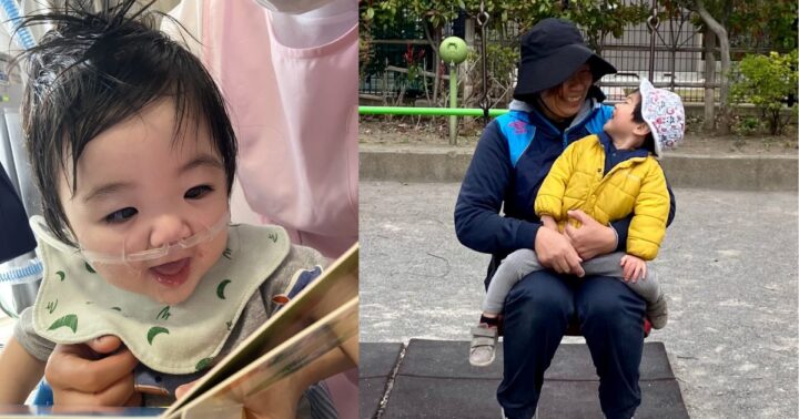お子さんの人工呼吸器をつけた姿と、成長して呼吸器が必要なくなり担任の先生とブランコに乗っている姿